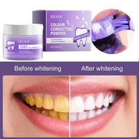Smile Club Teeth Whitening Powder ✨