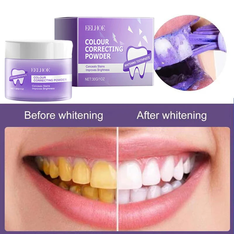 Smile Club Teeth Whitening Powder ✨