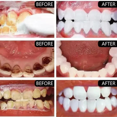 Reveal Your Brighter Smile, Radiate Confidence