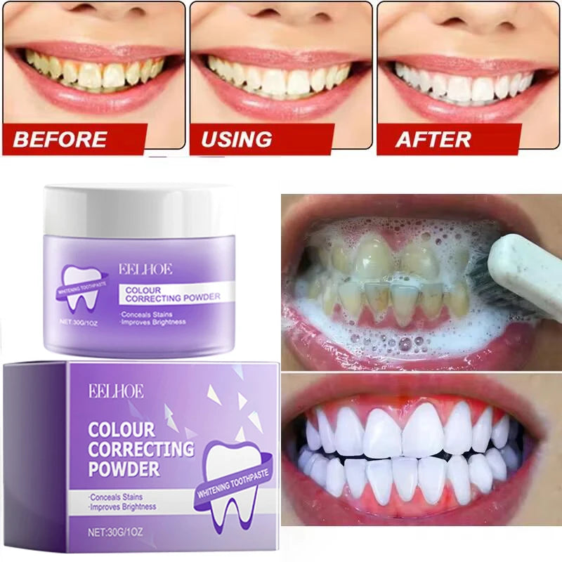 Smile Club Teeth Whitening Powder ✨