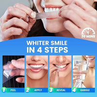 Smile Club 5D Teeth Whitening Strips ✨